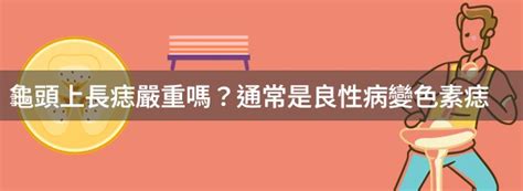 龜頭上有痣|泌尿科問題：龜頭皮膚龜裂及黑痣是否正常？